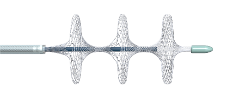 國內(nèi)首創(chuàng)！本市研發(fā)生產(chǎn)的1款Ⅲ類創(chuàng)新醫(yī)療器械獲批上市，為具有溶栓禁忌癥的患者提供了治療選擇